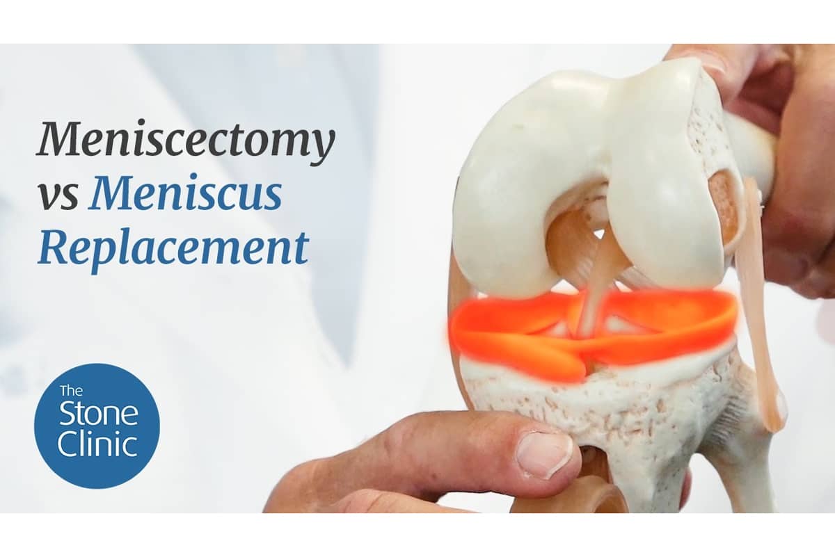 Meniscectomy Vs Meniscus Replacement Video Blog